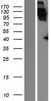 APOER2 / LRP8 Protein - Western validation with an anti-DDK antibody * L: Control HEK293 lysate R: Over-expression lysate