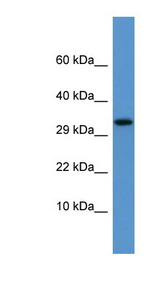 APOF / Apolipoprotein F Antibody - APOF / Apolipoprotein F antibody Western blot of Rat Kidney lysate. This image was taken for the unconjugated form of this product. Other forms have not been tested.