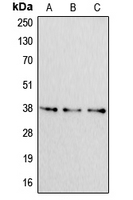 APOF / Apolipoprotein F Antibody - Western blot analysis of Apolipoprotein F expression in HeLa (A); NIH3T3 (B); H9C2 (C) whole cell lysates.