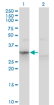 APOF / Apolipoprotein F Antibody - Western blot of APOF expression in transfected 293T cell line by APOF antibody.