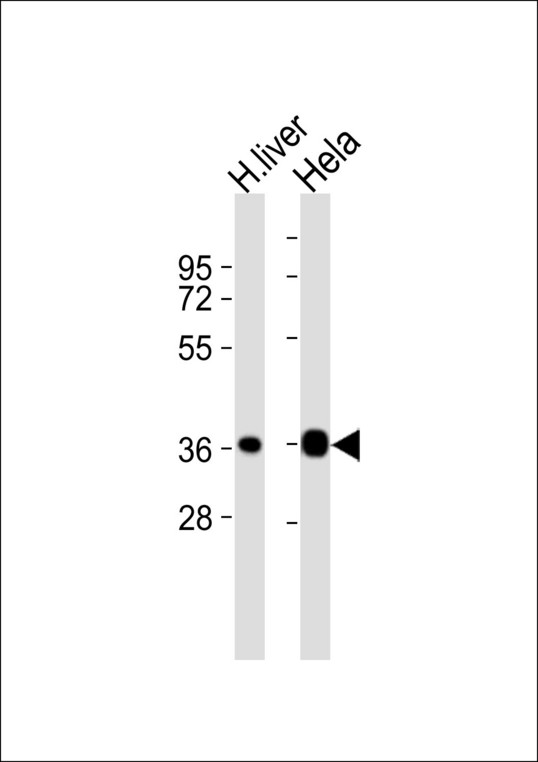 APOF / Apolipoprotein F Antibody - All lanes : Anti-Apolipoprotein F Antibody at 1:1000 dilution Lane 1: human liver lysates Lane 2: HeLa whole cell lysates Lysates/proteins at 20 ug per lane. Secondary Goat Anti-Rabbit IgG, (H+L),Peroxidase conjugated at 1/10000 dilution Predicted band size : 35 kDa Blocking/Dilution buffer: 5% NFDM/TBST.