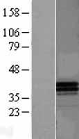 APOF / Apolipoprotein F Protein - Western validation with an anti-DDK antibody * L: Control HEK293 lysate R: Over-expression lysate