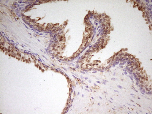 APOH / Apolipoprotein H Antibody - Immunohistochemical staining of paraffin-embedded Human prostate tissue within the normal limits using anti-APOH mouse monoclonal antibody. (Heat-induced epitope retrieval by 1 mM EDTA in 10mM Tris, pH8.5, 120C for 3min,
