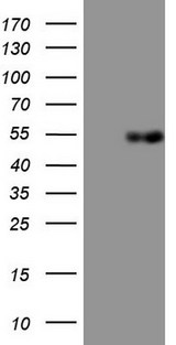 APOH / Apolipoprotein H Antibody - HEK293T cells were transfected with the pCMV6-ENTRY control (Left lane) or pCMV6-ENTRY APOH (Right lane) cDNA for 48 hrs and lysed. Equivalent amounts of cell lysates (5 ug per lane) were separated by SDS-PAGE and immunoblotted with anti-APOH.