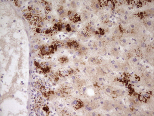 APOH / Apolipoprotein H Antibody - Immunohistochemical staining of paraffin-embedded Human liver tissue within the normal limits using anti-APOH mouse monoclonal antibody. (Heat-induced epitope retrieval by 1 mM EDTA in 10mM Tris, pH8.5, 120C for 3min,
