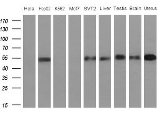 APOH / Apolipoprotein H Antibody - Western blot of extracts (10ug) from 5 different cell lines and 4 human tissue by using anti-APOH monoclonal antibody (1: HeLa; 2: HepG2; 3: K562; 4: Mcf7; 5: SVT2; 6: Liver; 7: Testis; 8: Brain; 9: Uterus) at 1:200 dilution.