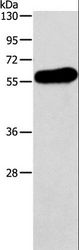 APOH / Apolipoprotein H Antibody - Western blot analysis of Human testis tissue, using APOH Polyclonal Antibody at dilution of 1:275.