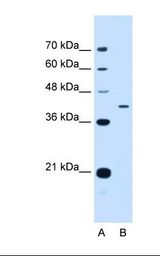 APOH / Apolipoprotein H Antibody - Lane A: Marker. Lane B: HepG2 cell lysate. Antibody concentration: 0.5 ug/ml. Gel concentration: 12%.  This image was taken for the unconjugated form of this product. Other forms have not been tested.