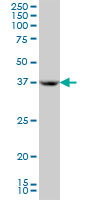 APOH / Apolipoprotein H Antibody - APOH monoclonal antibody (M01A), clone 3F10 Western Blot analysis of APOH expression in HL-60.