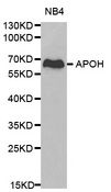 APOH / Apolipoprotein H Antibody - Western blot analysis of NB4 cell lysate.