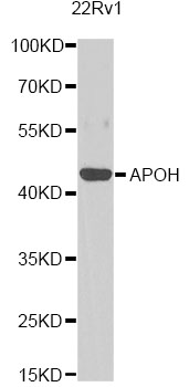APOH / Apolipoprotein H Antibody - Western blot analysis of extracts of 22Rv1 cells, using APOH antibody at 1:1000 dilution. The secondary antibody used was an HRP Goat Anti-Rabbit IgG (H+L) at 1:10000 dilution. Lysates were loaded 25ug per lane and 3% nonfat dry milk in TBST was used for blocking. An ECL Kit was used for detection and the exposure time was 30s.