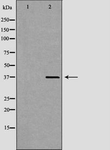 APOH / Apolipoprotein H Antibody - Western blot analysis of NB4 lysate using APOH antibody. The lane on the left is treated with the antigen-specific peptide.