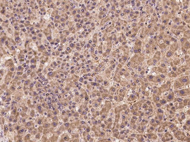 APOH / Apolipoprotein H Antibody - Immunochemical staining of human APOH in human liver with rabbit polyclonal antibody at 1:100 dilution, formalin-fixed paraffin embedded sections.