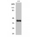 APOL1 / Apolipoprotein L Antibody - Western blot of ApoL1 antibody