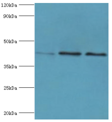 APOL1 / Apolipoprotein L Antibody - Western blot. All lanes: Apolipoprotein L1 antibody at 10 ug/ml. Lane 1: A549 whole cell lysate. Lane 2: HeLa whole cell lysate. Lane 3: HepG2 whole cell lysate. secondary Goat polyclonal to rabbit at 1:10000 dilution. Predicted band size: 44 kDa. Observed band size: 44 kDa.
