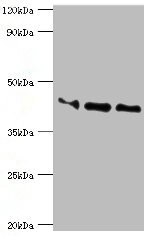 APOL1 / Apolipoprotein L Antibody - Western blot All lanes: Apolipoprotein L1 antibody at 10µg/ml Lane 1: A549 whole cell lysate Lane 2: Hela whole cell lysate Lane 3: HepG2 whole cell lysate Secondary Goat polyclonal to rabbit IgG at 1/10000 dilution Predicted band size: 44, 46, 43 kDa Observed band size: 44 kDa