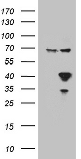 APOL1 / Apolipoprotein L Antibody - HEK293T cells were transfected with the pCMV6-ENTRY control. (Left lane) or pCMV6-ENTRY APOL1. (Right lane) cDNA for 48 hrs and lysed