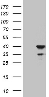 APOL1 / Apolipoprotein L Antibody - HEK293T cells were transfected with the pCMV6-ENTRY control. (Left lane) or pCMV6-ENTRY APOL1. (Right lane) cDNA for 48 hrs and lysed