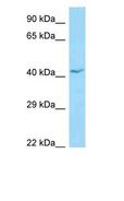APOL1 / Apolipoprotein L Antibody - APOL1 / Apolipoprotein L antibody Western Blot of OVCAR-3.  This image was taken for the unconjugated form of this product. Other forms have not been tested.