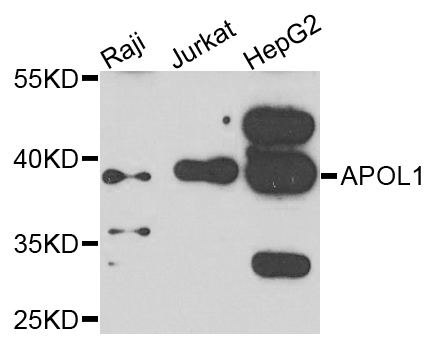 APOL1 / Apolipoprotein L Antibody - Western blot analysis of extracts of various cells.