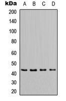 APOL1 / Apolipoprotein L Antibody - Western blot analysis of Apolipoprotein L1 expression in MCF7 (A); HeLa (B); NS-1 (C); PC12 (D) whole cell lysates.