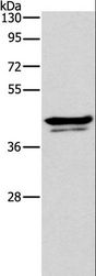 APOL1 / Apolipoprotein L Antibody - Western blot analysis of Human plasma tissue, using APOL1 Polyclonal Antibody at dilution of 1:300.