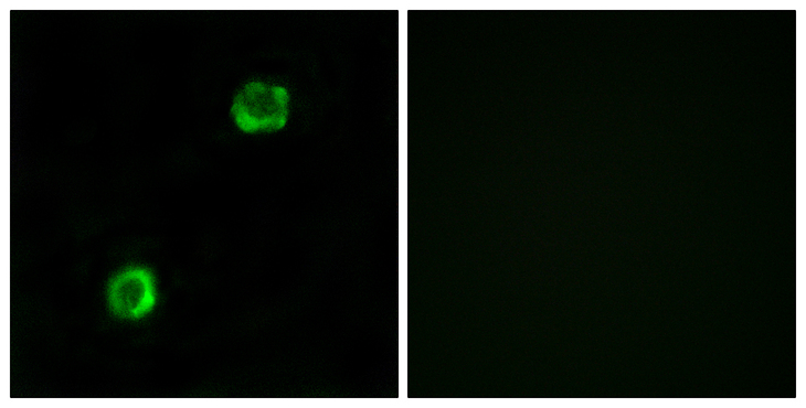 APOL2 / Apolipoprotein L 2 Antibody - Immunofluorescence analysis of MCF7 cells, using APOL2 Antibody. The picture on the right is blocked with the synthesized peptide.