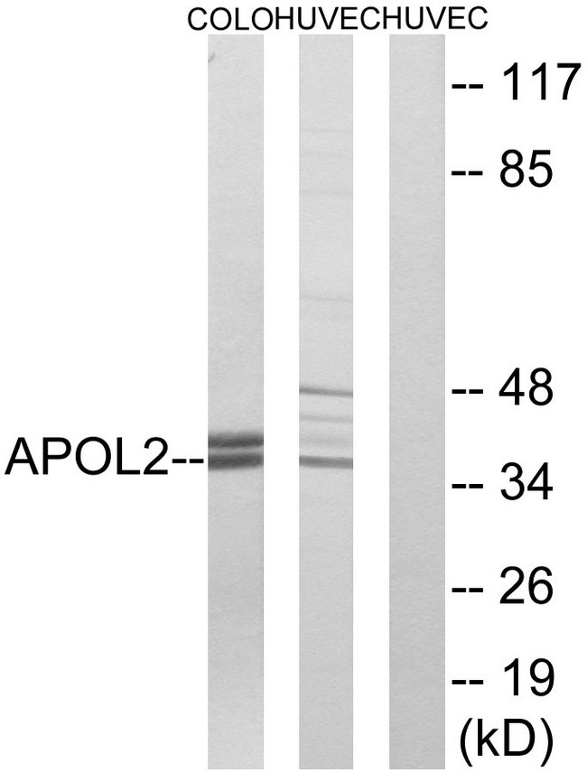 APOL2 / Apolipoprotein L 2 Antibody - Western blot analysis of lysates from HUVEC and COLO cells, using APOL2 Antibody. The lane on the right is blocked with the synthesized peptide.