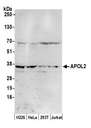 APOL2 / Apolipoprotein L 2 Antibody - Detection of human APOL2 by western blot. Samples: Whole cell lysate (50 µg) from NCI-NCI-H226, HeLa, HEK293T, and Jurkat cells prepared using NETN lysis buffer. Antibody: Affinity purified rabbit anti-APOL2 antibody used for WB at 1:1000. Detection: Chemiluminescence with an exposure time of 3 minutes.