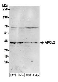 APOL2 / Apolipoprotein L 2 Antibody - Detection of human APOL2 by western blot. Samples: Whole cell lysate (50 µg) from NCI-NCI-H226, HeLa, HEK293T, and Jurkat cells prepared using NETN lysis buffer. Antibody: Affinity purified rabbit anti-APOL2 antibody used for WB at 1:1000. Detection: Chemiluminescence with an exposure time of 3 minutes.