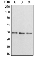APOL2 / Apolipoprotein L 2 Antibody - Western blot analysis of Apolipoprotein L2 expression in HepG2 (A); mouse liver (B); rat brain (C) whole cell lysates.