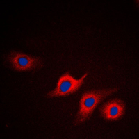 APOL2 / Apolipoprotein L 2 Antibody - Immunofluorescent analysis of Apolipoprotein L2 staining in HepG2 cells. Formalin-fixed cells were permeabilized with 0.1% Triton X-100 in TBS for 5-10 minutes and blocked with 3% BSA-PBS for 30 minutes at room temperature. Cells were probed with the primary antibody in 3% BSA-PBS and incubated overnight at 4 C in a humidified chamber. Cells were washed with PBST and incubated with a DyLight 594-conjugated secondary antibody (red) in PBS at room temperature in the dark. DAPI was used to stain the cell nuclei (blue).