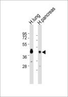 APOL2 / Apolipoprotein L 2 Antibody - All lanes : Anti-Apolipoprotein L2 Antibody at 1:1000 dilution Lane 1: H.lung tissue lysates Lane 2: H.pancreas tissue lysates Lysates/proteins at 20 ug per lane. Secondary Goat Anti-Rabbit IgG, (H+L),Peroxidase conjugated at 1/10000 dilution Predicted band size : 37 kDa Blocking/Dilution buffer: 5% NFDM/TBST.