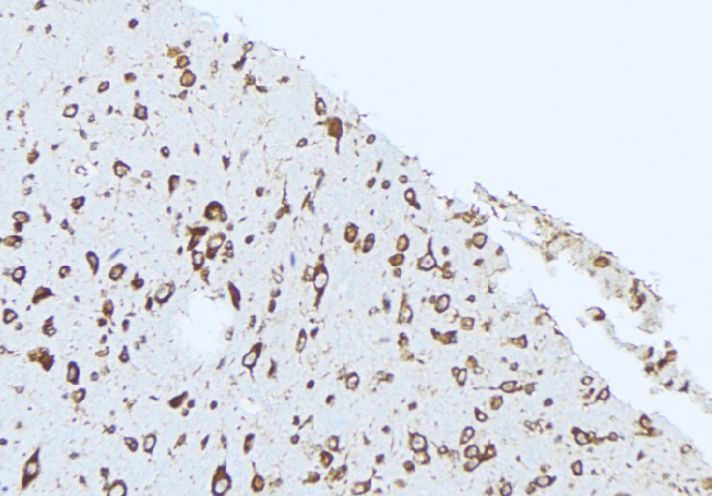APOL2 / Apolipoprotein L 2 Antibody - 1:100 staining rat brain tissue by IHC-P. The sample was formaldehyde fixed and a heat mediated antigen retrieval step in citrate buffer was performed. The sample was then blocked and incubated with the antibody for 1.5 hours at 22°C. An HRP conjugated goat anti-rabbit antibody was used as the secondary.