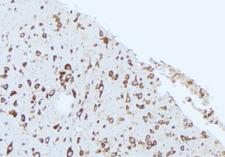 APOL2 / Apolipoprotein L 2 Antibody - 1:100 staining rat brain tissue by IHC-P. The sample was formaldehyde fixed and a heat mediated antigen retrieval step in citrate buffer was performed. The sample was then blocked and incubated with the antibody for 1.5 hours at 22°C. An HRP conjugated goat anti-rabbit antibody was used as the secondary.