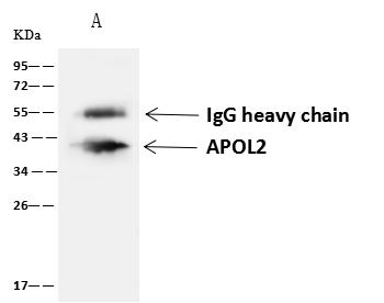 APOL2 / Apolipoprotein L 2 Antibody - APOL2 was immunoprecipitated using: Lane A: 0.5 mg U-251MG Whole Cell Lysate. 4 uL anti-APOL2 rabbit polyclonal antibody and 60 ug of Immunomagnetic beads Protein A/G. Primary antibody: Anti-APOL2 rabbit polyclonal antibody, at 1:100 dilution. Secondary antibody: Goat Anti-Rabbit IgG (H+L)/HRP at 1/10000 dilution. Developed using the ECL technique. Performed under reducing conditions. Predicted band size: 37 kDa. Observed band size: 40 kDa.