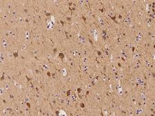 APOL2 / Apolipoprotein L 2 Antibody - Immunochemical staining of human APOL2 in human brain with rabbit polyclonal antibody at 1:500 dilution, formalin-fixed paraffin embedded sections.