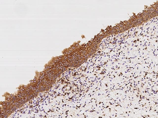 APOL2 / Apolipoprotein L 2 Antibody - Immunochemical staining of human APOL2 in human urinary bladder with rabbit polyclonal antibody at 1:500 dilution, formalin-fixed paraffin embedded sections.