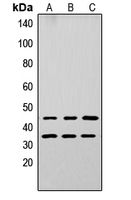 APOL3 / Apolipoprotein L 3 Antibody - Western blot analysis of Apolipoprotein L3 expression in A549 (A); PC12 (B); NS-1 (C) whole cell lysates.