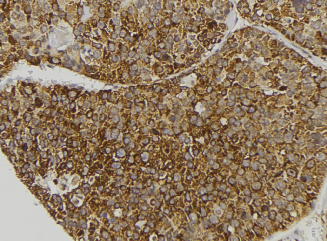 APOL3 / Apolipoprotein L 3 Antibody - 1:100 staining human pancreas tissue by IHC-P. The sample was formaldehyde fixed and a heat mediated antigen retrieval step in citrate buffer was performed. The sample was then blocked and incubated with the antibody for 1.5 hours at 22°C. An HRP conjugated goat anti-rabbit antibody was used as the secondary.