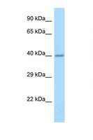 APOL4 / Apolipoprotein L 4 Antibody - APOL4 / Apolipoprotein L 4 antibody Western blot of Fetal Brain lysate. Antibody concentration 1 ug/ml.  This image was taken for the unconjugated form of this product. Other forms have not been tested.