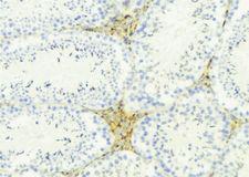 APOL4 / Apolipoprotein L 4 Antibody - 1:100 staining mouse testis tissue by IHC-P. The sample was formaldehyde fixed and a heat mediated antigen retrieval step in citrate buffer was performed. The sample was then blocked and incubated with the antibody for 1.5 hours at 22°C. An HRP conjugated goat anti-rabbit antibody was used as the secondary.