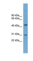 APOL5 / Apolipoprotein L 5 Antibody - APOL5 / Apolipoprotein L 5 antibody Western blot of Fetal Heart lysate. This image was taken for the unconjugated form of this product. Other forms have not been tested.