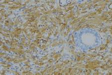 APOL5 / Apolipoprotein L 5 Antibody - 1:100 staining human uterus tissue by IHC-P. The sample was formaldehyde fixed and a heat mediated antigen retrieval step in citrate buffer was performed. The sample was then blocked and incubated with the antibody for 1.5 hours at 22°C. An HRP conjugated goat anti-rabbit antibody was used as the secondary.