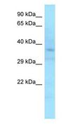 APOL6 / Apolipoprotein L 6 Antibody - APOL6 / Apolipoprotein L 6 antibody Western Blot of 721_B.  This image was taken for the unconjugated form of this product. Other forms have not been tested.