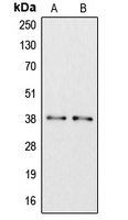 APOL6 / Apolipoprotein L 6 Antibody - Western blot analysis of Apolipoprotein L6 expression in COLO205 (A); K562 (B) whole cell lysates.