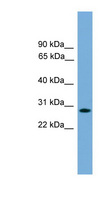 APOLD1 / Apolipoprotein L D1 Antibody - APOLD1 / Apolipoprotein L D1 antibody Western blot of Jurkat lysate. This image was taken for the unconjugated form of this product. Other forms have not been tested.