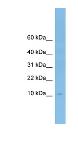 Apolipoprotein A-II Antibody - APOA2 antibody Western blot of OVCAR-3 cell lysate. This image was taken for the unconjugated form of this product. Other forms have not been tested.