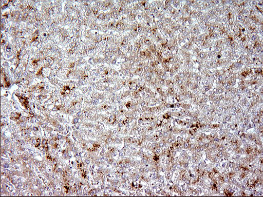 Apolipoprotein A-V Antibody - IHC of paraffin-embedded Human liver tissue using anti-APOA5 mouse monoclonal antibody. (Heat-induced epitope retrieval by 1 mM EDTA in 10mM Tris, pH8.5, 120°C for 3min).