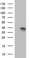 Apolipoprotein A-V Antibody - HEK293T cells were transfected with the pCMV6-ENTRY control (Left lane) or pCMV6-ENTRY APOA5 (Right lane) cDNA for 48 hrs and lysed. Equivalent amounts of cell lysates (5 ug per lane) were separated by SDS-PAGE and immunoblotted with anti-APOA5.